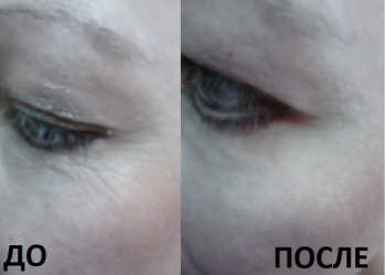Антивозрастная серия-BeautyLine Anti-Aging Tripl лифтинг 3 в 1