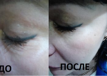Антивозрастная серия-BeautyLine Anti-Aging Tripl лифтинг 3 в 1