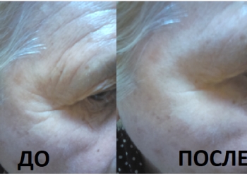 Антивозрастная серия-BeautyLine Anti-Aging Tripl лифтинг 3 в 1