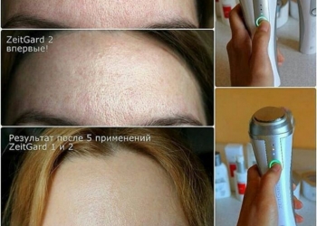 Бьюти гаджеты Zeitgard