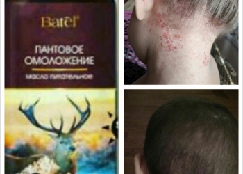 Пантовое масло