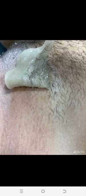 Шугаринг эпиляция