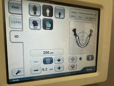 Компьютерный томограф стоматологический Gendex 700