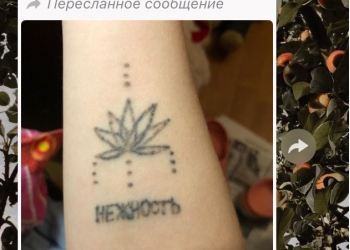 Удаление тату, татуажа, пигментных пятен лазером