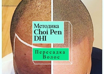 Пластическая хирургия