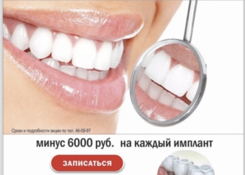 Имплантация зубов в Хабаровске