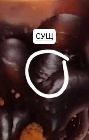 ������� �� ����, ������ �������� �������