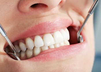 Протезирование зубов в Китае