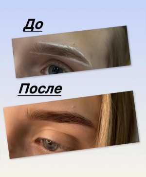 ������