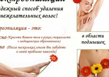 Электроэпиляция