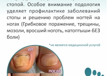 Приём подолога