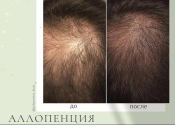 Холодная плазма