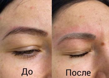 Удаление лазером тату и татуаж, карбоновый пилинг