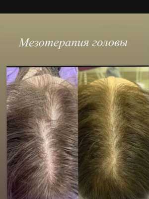 Скидка 10% перед новым годом! Успейте сделать красоту выгодно!